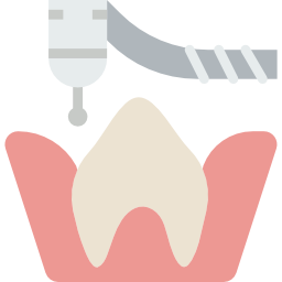 molar-1