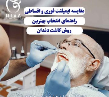 معاینه دندان یک آقای میانسال برای بررسی گزینه‌های ایمپلنت فوری و اقساطی