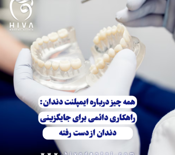 قالب دندان یا دندانهای مصنوعی که نمایانگر فرآیند ایمپلنت دندان و جایگزینی دندان از دست رفته هستند