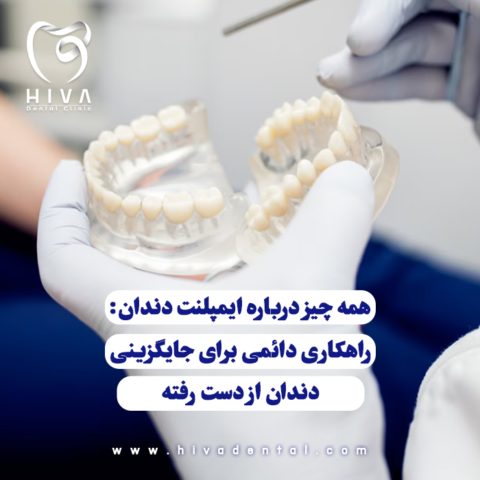 قالب دندان یا دندانهای مصنوعی که نمایانگر فرآیند ایمپلنت دندان و جایگزینی دندان از دست رفته هستند