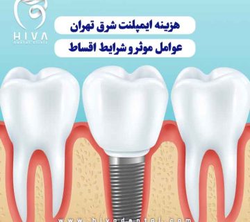 نمای نزدیک گرافیکی از دندان برای نمایش عوامل مؤثر در هزینه ایمپلنت و شرایط اقساط در شرق تهران