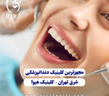 مجهزترین کلینیک دندانپزشکی شرق تهران با تجهیزات پیشرفته و خدمات تخصصی | کلینیک هیوا