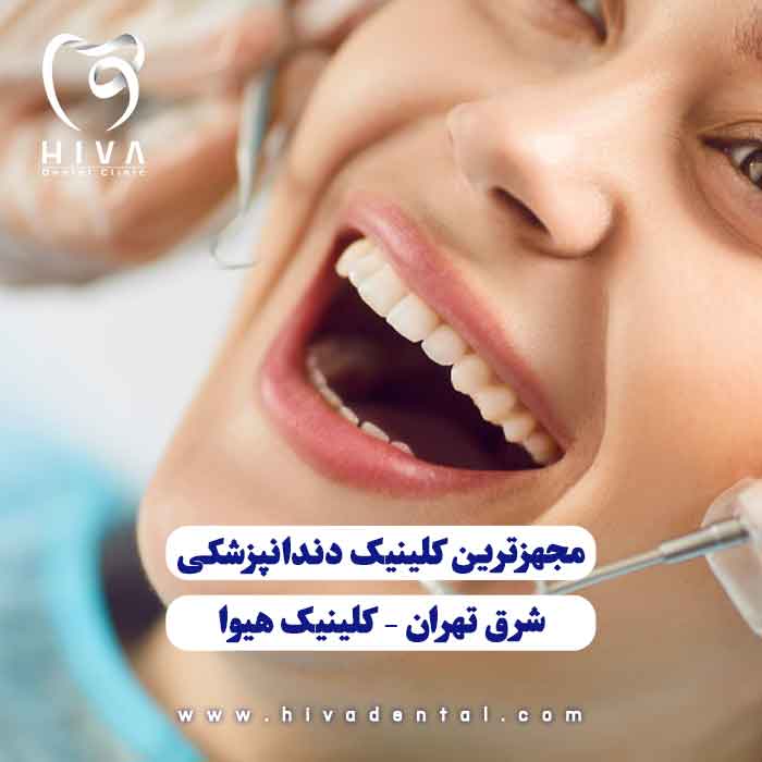 مجهزترین کلینیک دندانپزشکی شرق تهران با تجهیزات پیشرفته و خدمات تخصصی | کلینیک هیوا