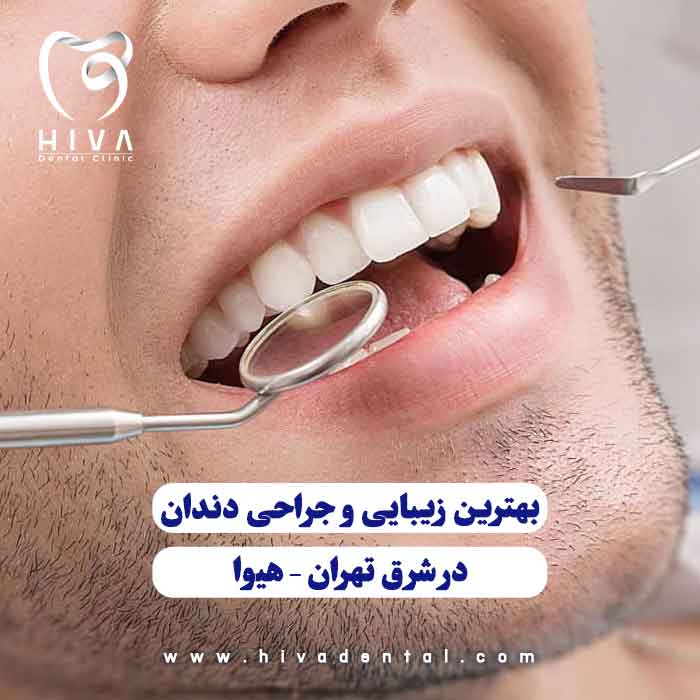 مراجعه بیمار برای زیبایی و جراحی دندان در کلینیک هیوا در شرق تهران