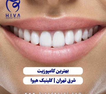 لبخند زیبا با دندانهای سفید و مرتب، نمادی از بهترین خدمات کامپوزیت شرق تهران در کلینیک دندانپزشکی هیوا