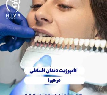 مراحل انتخاب رنگ و اجرای کامپوزیت اقساطی شرق تهران در کلینیک هیوا