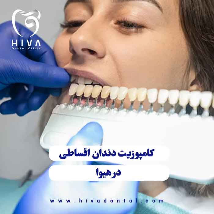مراحل انتخاب رنگ و اجرای کامپوزیت اقساطی شرق تهران در کلینیک هیوا