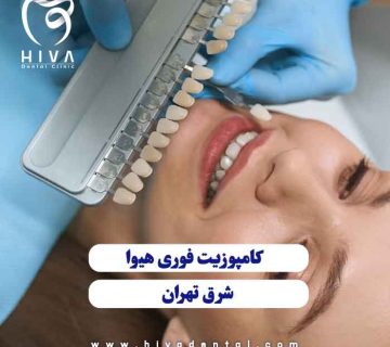 اصلاح لبخند با کامپوزیت فوری در شرق تهران کلینیک دندانپزشکی هیوا