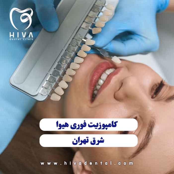 اصلاح لبخند با کامپوزیت فوری در شرق تهران کلینیک دندانپزشکی هیوا