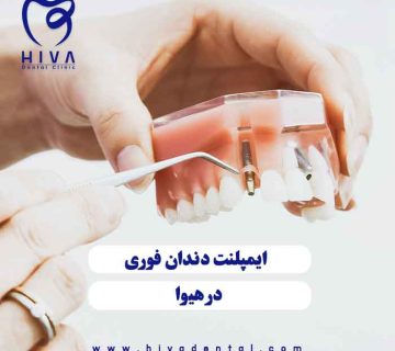 نمایش مدل جراحی و پایه گذاری ایمپلنت فوری شرق تهران در کلینیک هیوا